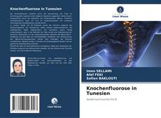 Couverture de Knochenfluorose in Tunesien