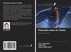 Fluorosis ósea en Túnez kitap kapağı