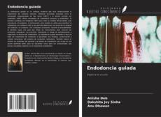 Portada del libro de Endodoncia guiada