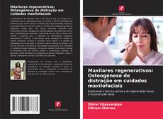 Buchcover von Maxilares regenerativos: Osteogénese de distração em cuidados maxilofaciais