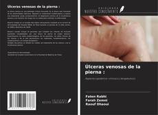 Bookcover of Úlceras venosas de la pierna :