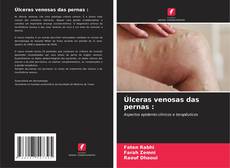 Buchcover von Úlceras venosas das pernas :