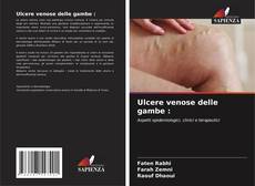 Bookcover of Ulcere venose delle gambe :
