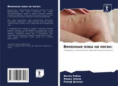 Capa do livro de Венозные язвы на ногах: 