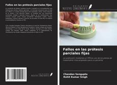 Bookcover of Fallos en las prótesis parciales fijas