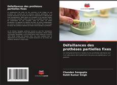 Bookcover of Défaillances des prothèses partielles fixes