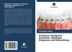 Palatinal verlagerte Eckzähne: Ätiologie, Diagnose und Behandlung kitap kapağı
