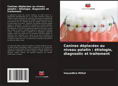Copertina di Canines déplacées au niveau palatin : étiologie, diagnostic et traitement