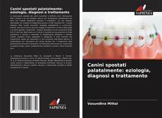 Bookcover of Canini spostati palatalmente: eziologia, diagnosi e trattamento
