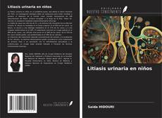 Portada del libro de Litiasis urinaria en niños