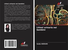 Bookcover of Litiasi urinaria nei bambini