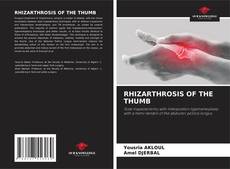 Buchcover von RHIZARTHROSIS OF THE THUMB