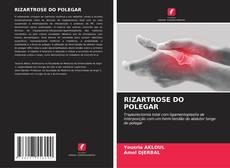 Capa do livro de RIZARTROSE DO POLEGAR 