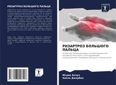 Bookcover of РИЗАРТРОЗ БОЛЬШОГО ПАЛЬЦА