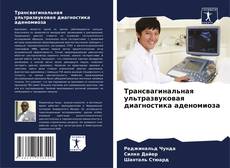 Couverture de Трансвагинальная ультразвуковая диагностика аденомиоза
