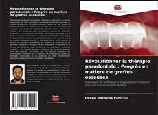Buchcover von Révolutionner la thérapie parodontale : Progrès en matière de greffes osseuses