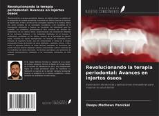Portada del libro de Revolucionando la terapia periodontal: Avances en injertos óseos