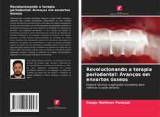 Bookcover of Revolucionando a terapia periodontal: Avanços em enxertos ósseos