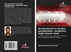 Bookcover of Rivoluzionare la terapia parodontale: I progressi degli innesti ossei