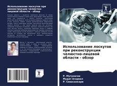 Bookcover of Использование лоскутов при реконструкции челюстно-лицевой области - обзор