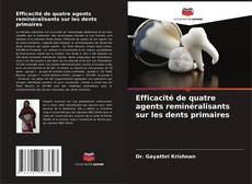 Bookcover of Efficacité de quatre agents reminéralisants sur les dents primaires