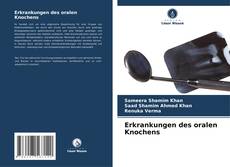 Bookcover of Erkrankungen des oralen Knochens