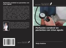 Bookcover of Perfusión cerebral en pacientes con ictus agudo