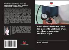 Capa do livro de Perfusion cérébrale chez les patients victimes d'un accident vasculaire cérébral aigu 