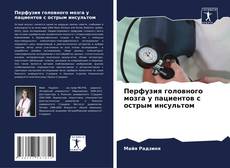 Bookcover of Перфузия головного мозга у пациентов с острым инсультом