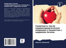 Bookcover of Смертность после кардиохирургических операций у пациентов с циррозом печени