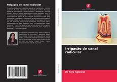 Buchcover von Irrigação de canal radicular
