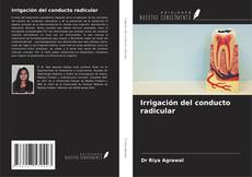 Capa do livro de Irrigación del conducto radicular 