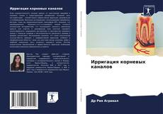 Capa do livro de Ирригация корневых каналов 