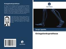 Couverture de Kniegelenksprothese