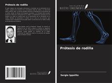 Capa do livro de Prótesis de rodilla 
