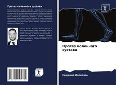 Capa do livro de Протез коленного сустава 