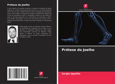 Portada del libro de Prótese do Joelho