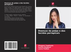 Buchcover von Doenças da polpa e dos tecidos periapicais