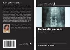 Buchcover von Radiografía avanzada