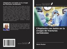 Bookcover of Cifoplastia con balón en la cirugía de fracturas vertebrales