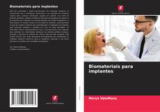 Biomateriais para implantes kitap kapağı
