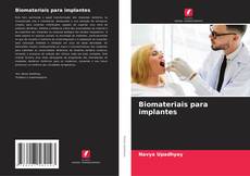 Capa do livro de Biomateriais para implantes 