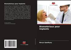 Buchcover von Biomatériaux pour implants
