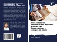 Bookcover of Допплеровская велосиметрия пупочной артерии при беременности с задержкой роста