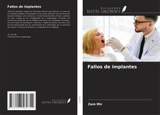 Bookcover of Fallos de implantes