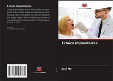 Échecs implantaires kitap kapağı