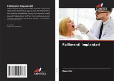 Bookcover of Fallimenti implantari