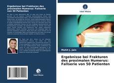 Bookcover of Ergebnisse bei Frakturen des proximalen Humerus: Fallserie von 50 Patienten