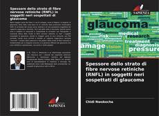 Bookcover of Spessore dello strato di fibre nervose retiniche (RNFL) in soggetti neri sospettati di glaucoma
