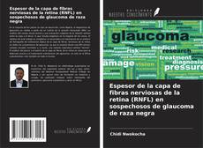 Bookcover of Espesor de la capa de fibras nerviosas de la retina (RNFL) en sospechosos de glaucoma de raza negra